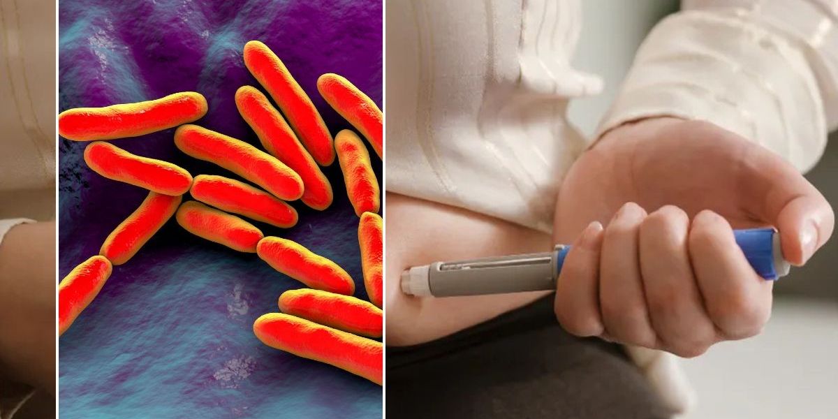 NextImg:'I'm a pharmacist - I'm seeing more patients on weight loss jabs with a long-lasting and severe side effect'