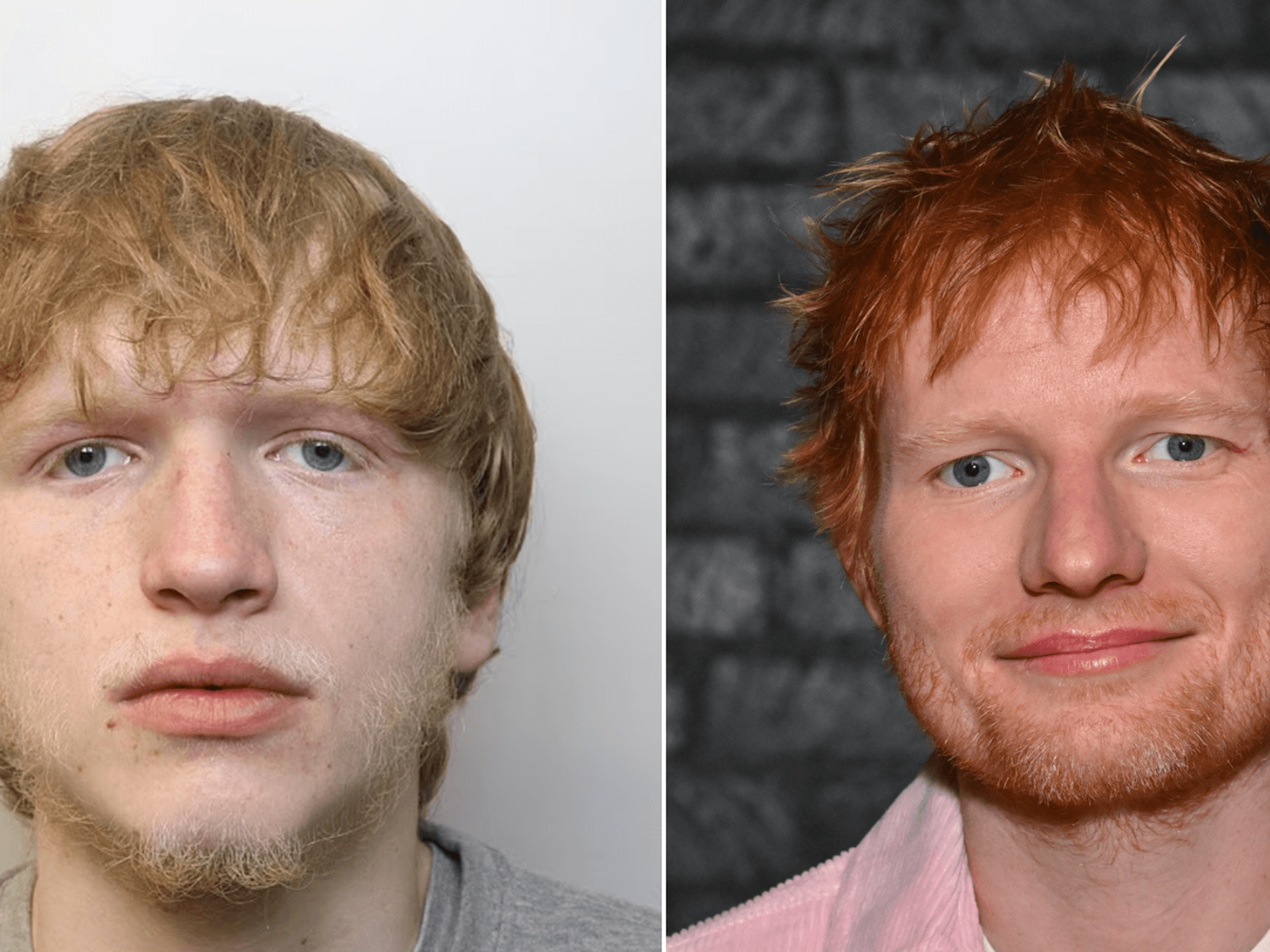Bailey Esmonde, Ed Sheeran