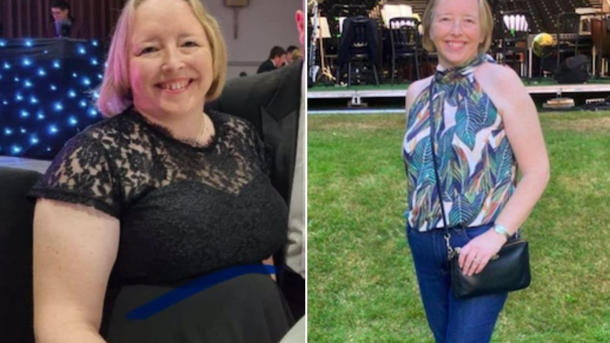 Before and after pictures of Erin