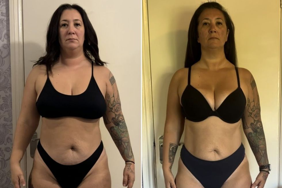 before and after pictures of Gemma