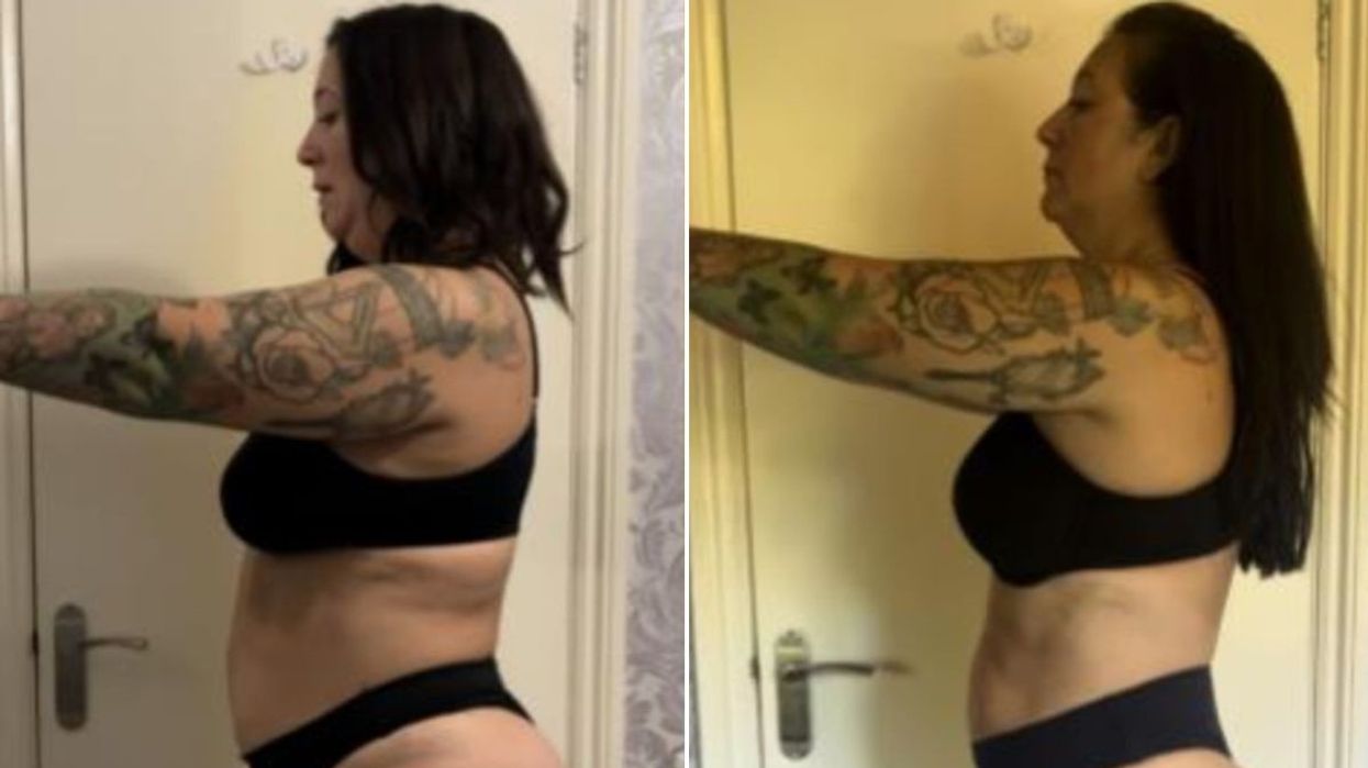 before and after pictures of Gemma