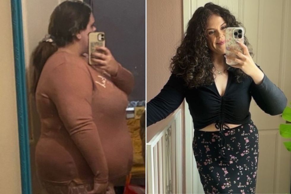 BEFORE AND AFTER PICTURES OF MEL