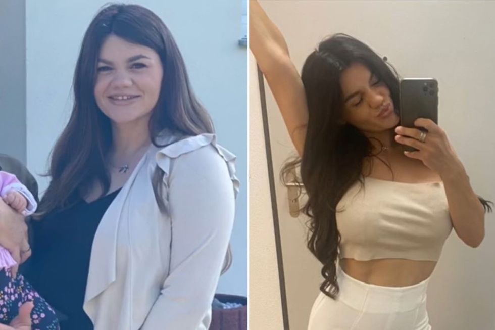 Before and after rooxy