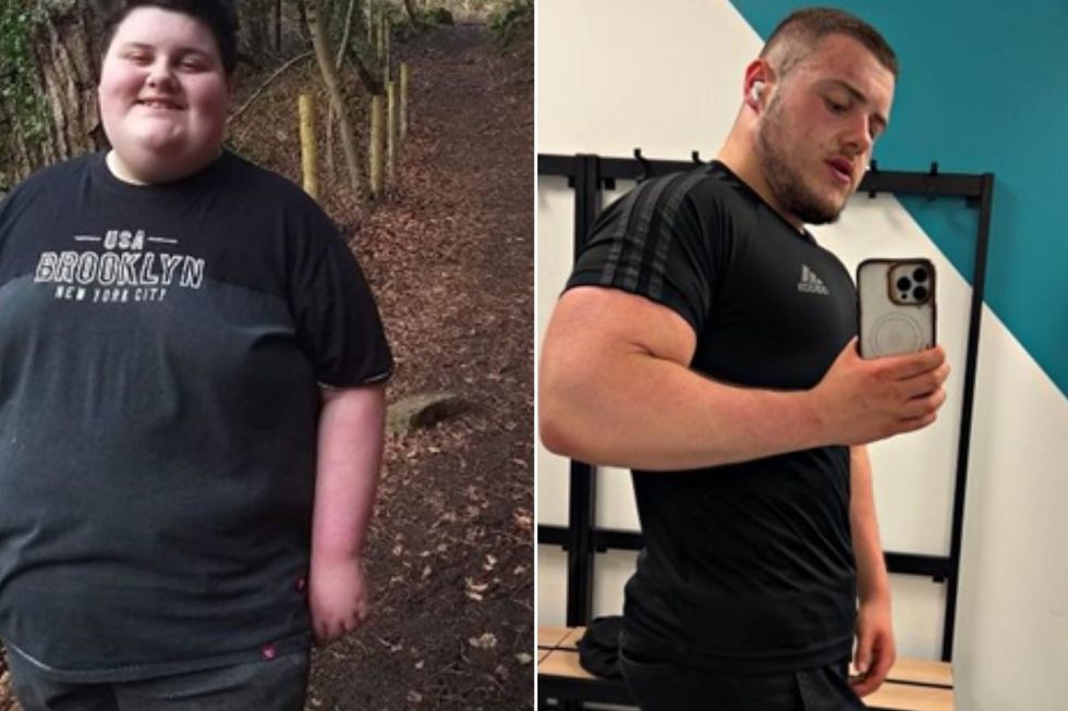 Before and after weight loss transformation