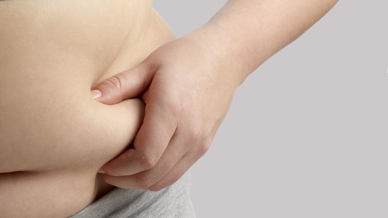 Belly fat stock image