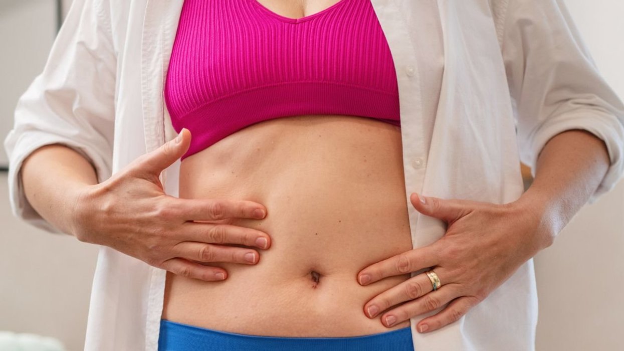 BELLY FAT STOCK IMAGE