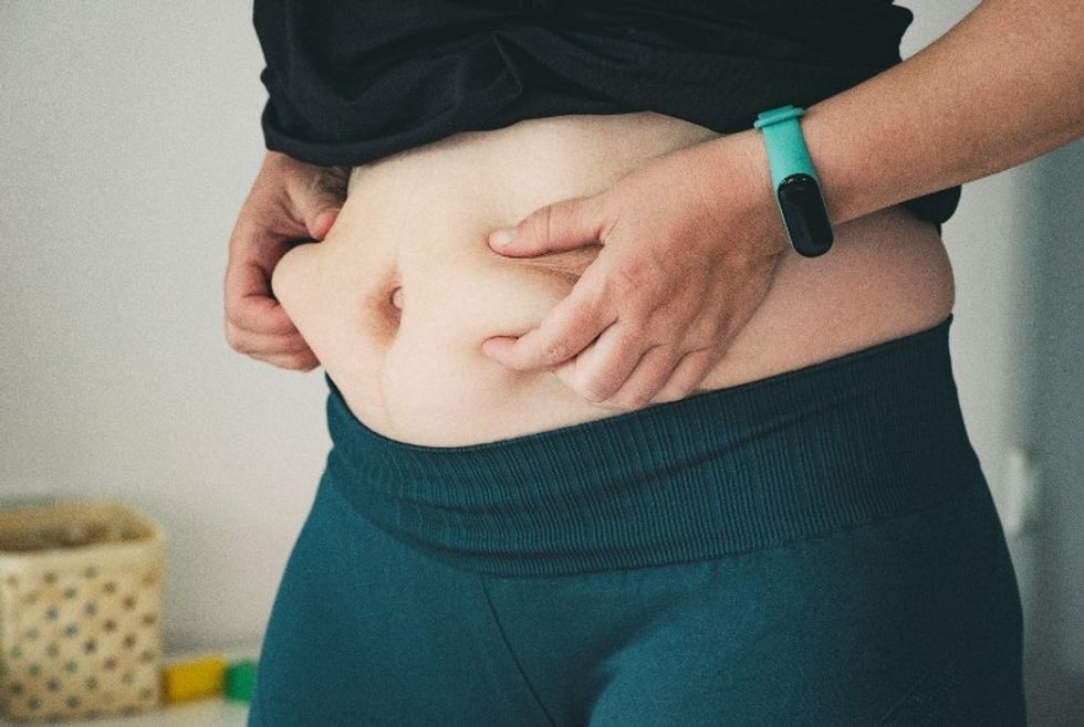 belly fat