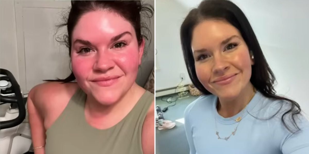 ‘I lost 7st 2lb on weight loss jabs but wasn’t prepared for the changes in my hair and skin’ ‘I lost 7st 2lb on weight loss jabs but wasn’t prepared for the changes in my hair and skin’