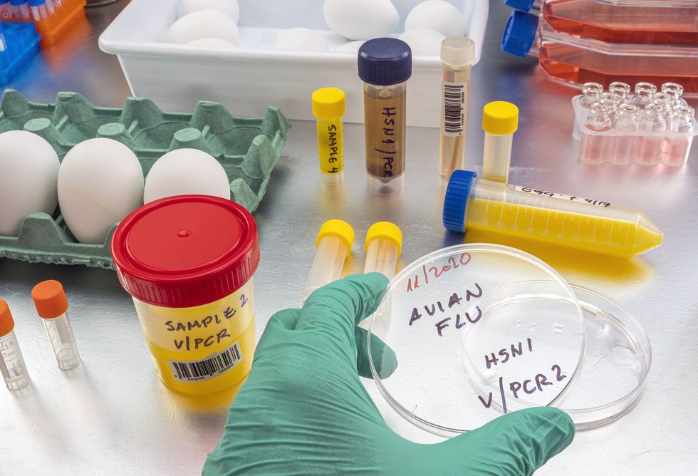 Bird flu testing