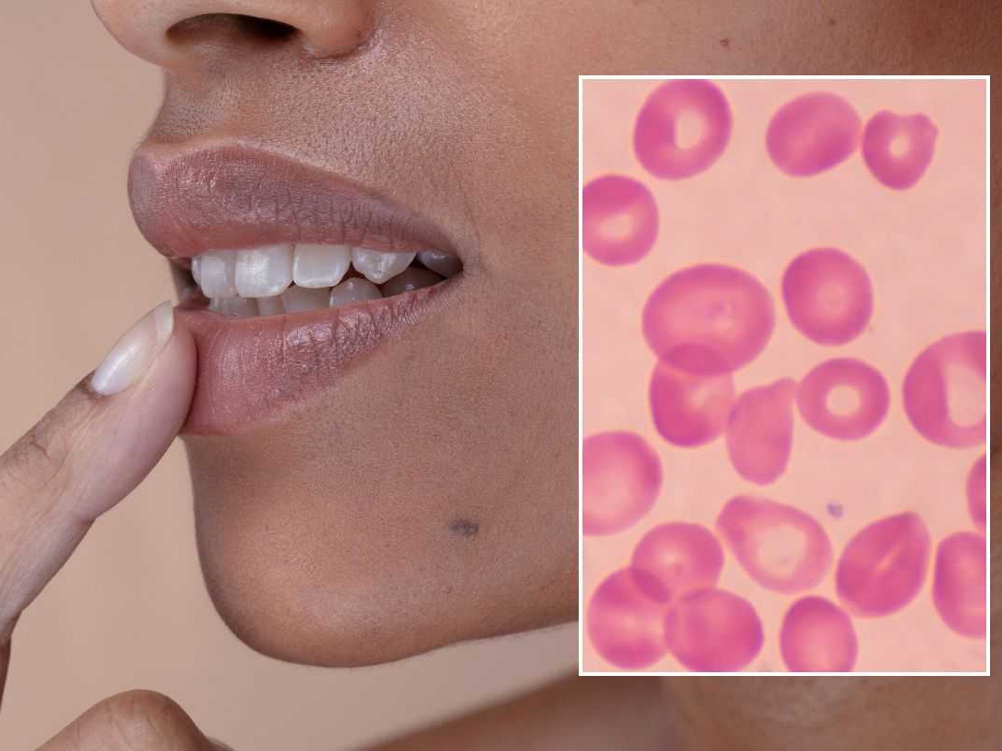 BLOOD CELLS UNDER MICROSCOPE