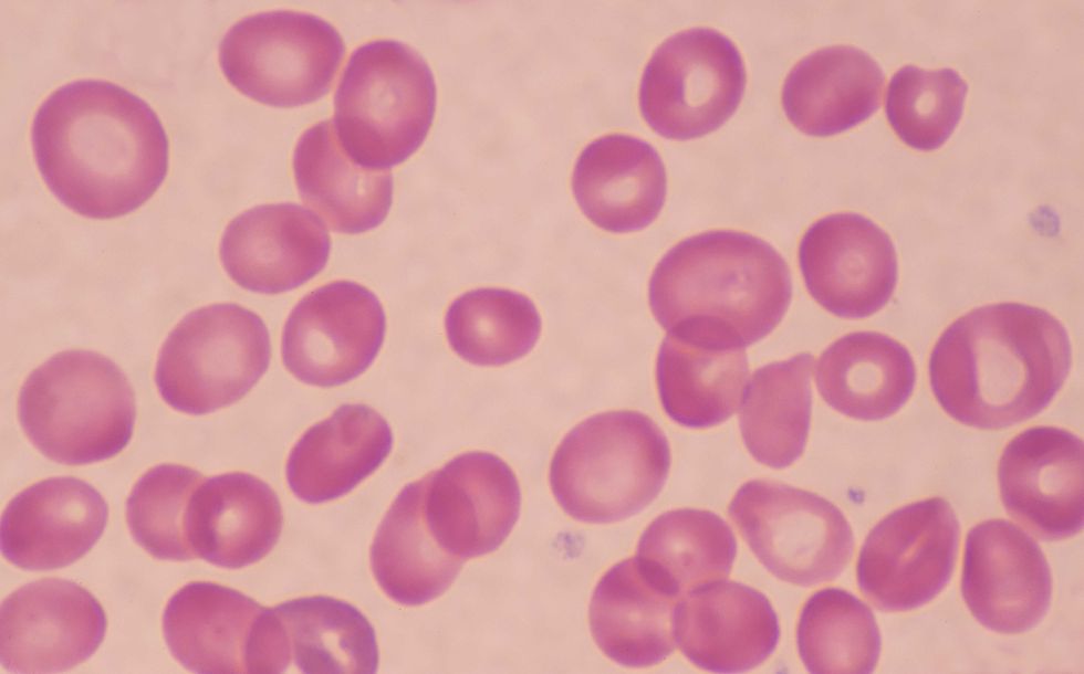 BLOOD CELLS UNDER MICROSCOPE