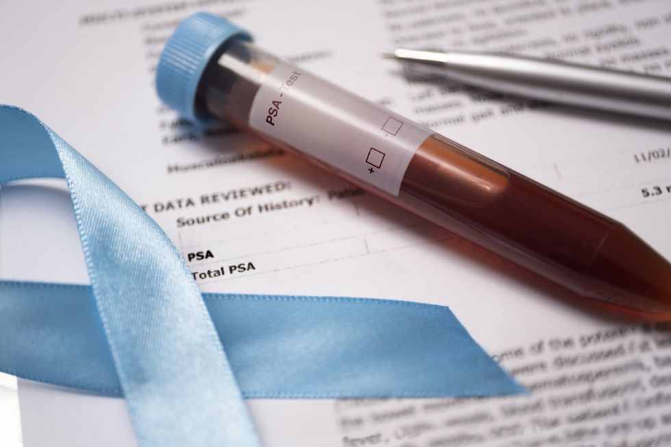 Blood sample