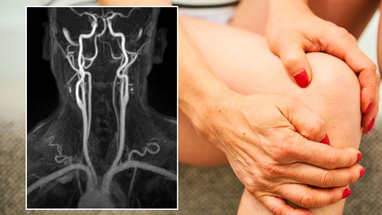 BLOOD VESSEL SCAN AND WOMAN CLUTCHING KNEE