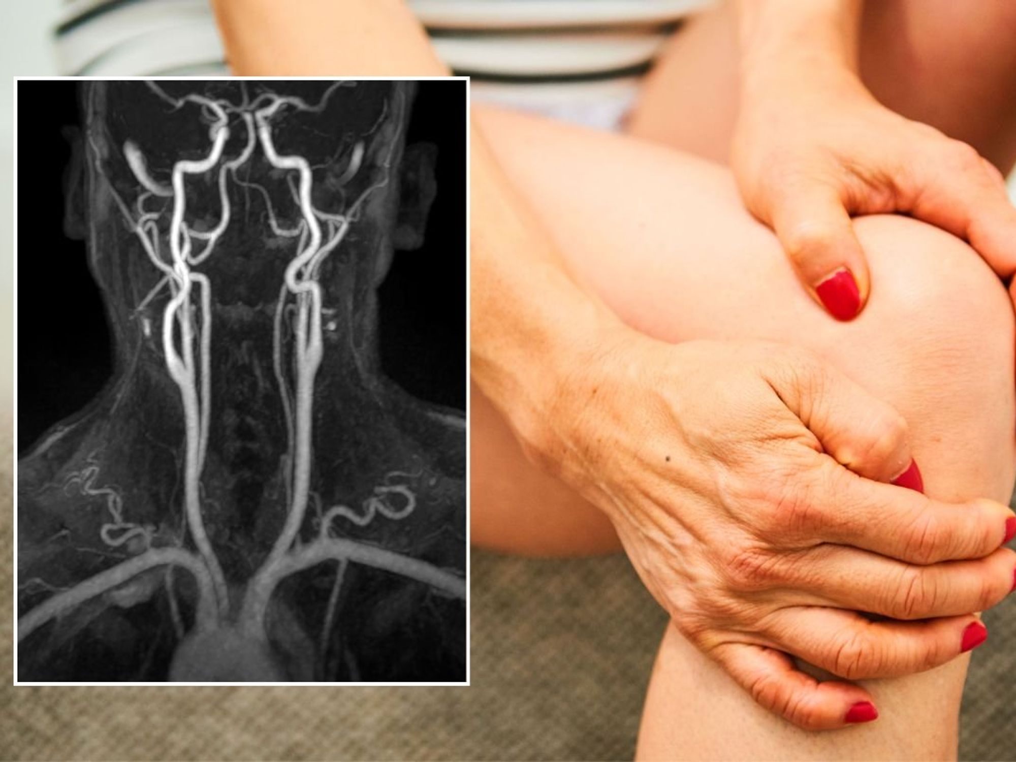 BLOOD VESSEL SCAN AND WOMAN CLUTCHING KNEE