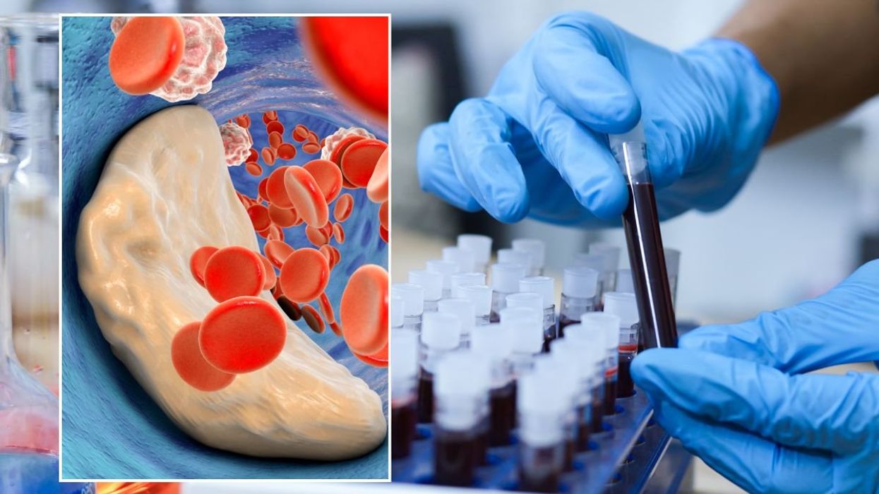 blood vial and cholesterol illustration