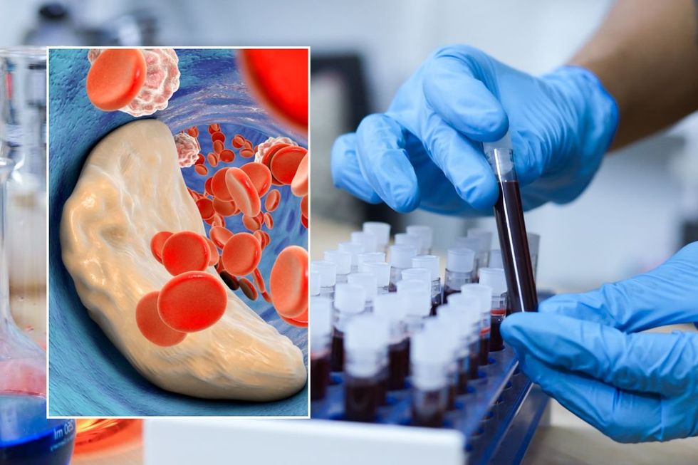 blood vial and cholesterol illustration