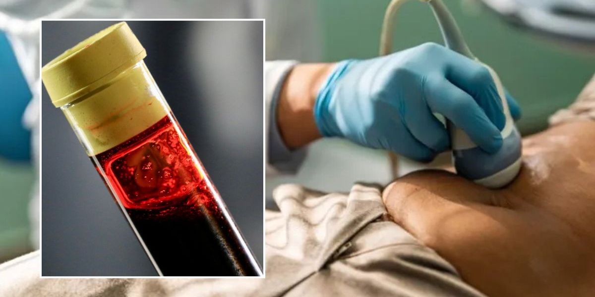 NextImg:Worried about forever chemicals? Key supplement found to flush cancer-causing substance from body
