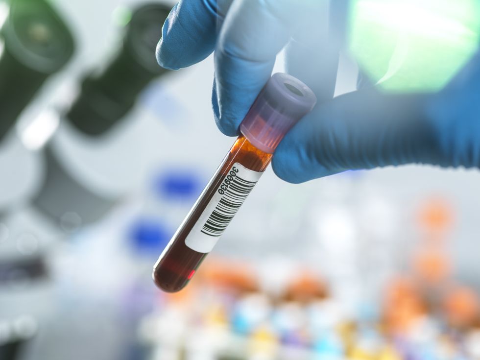 BLOOD VIAL