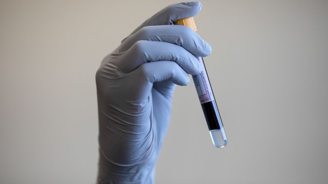 Blood vial