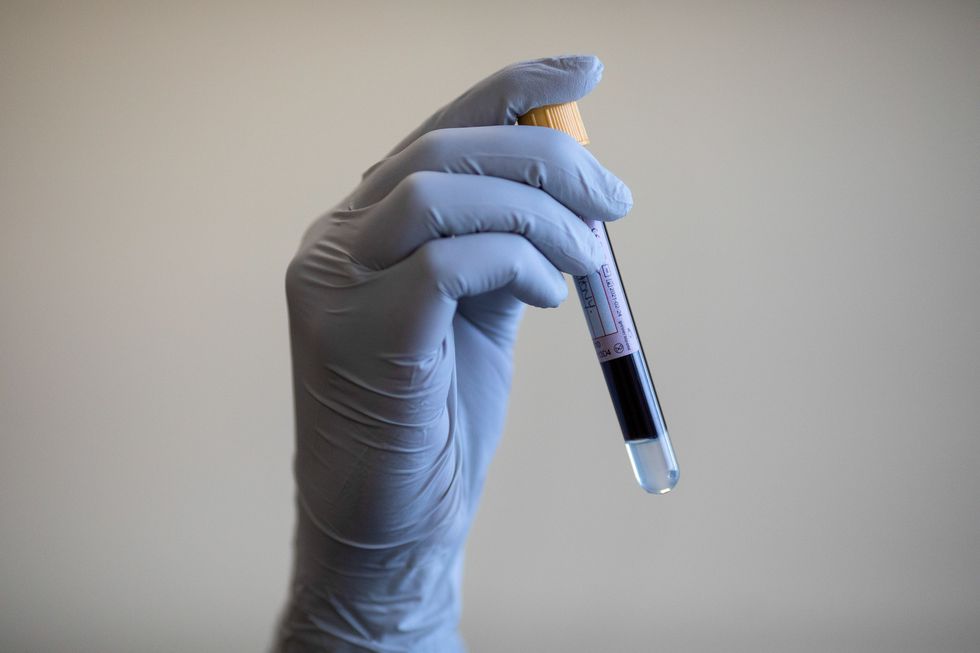 BLOOD VIAL