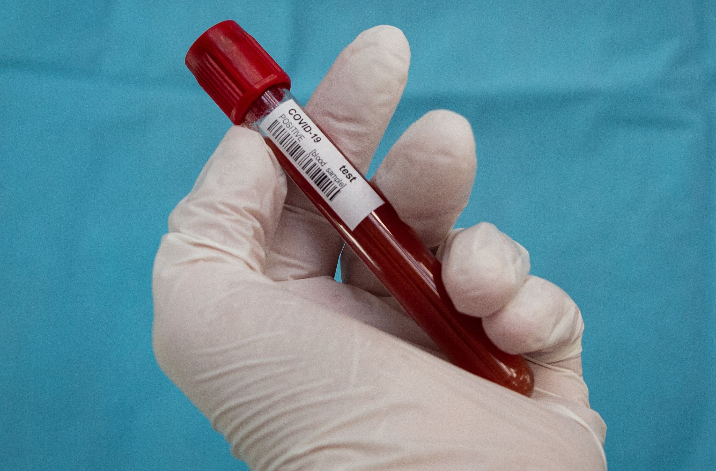 BLOOD VIAL