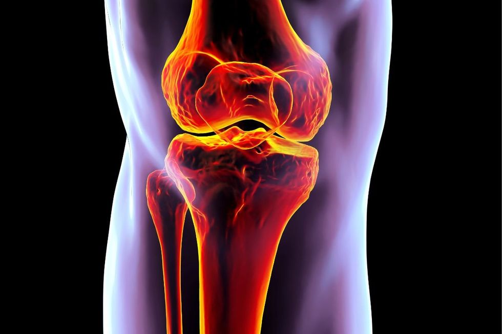 Bone composite
