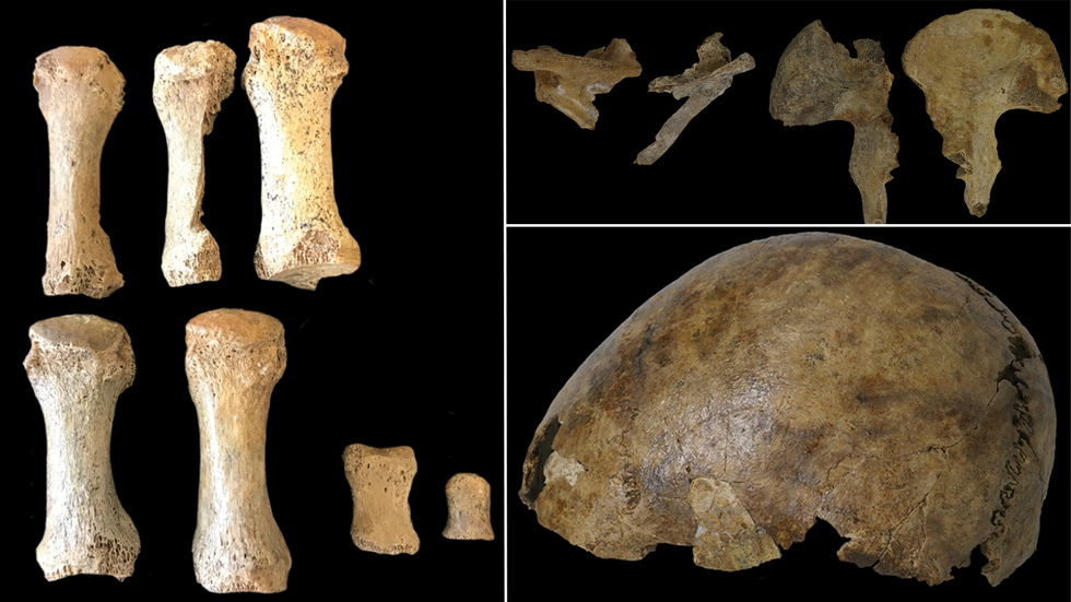 Bones