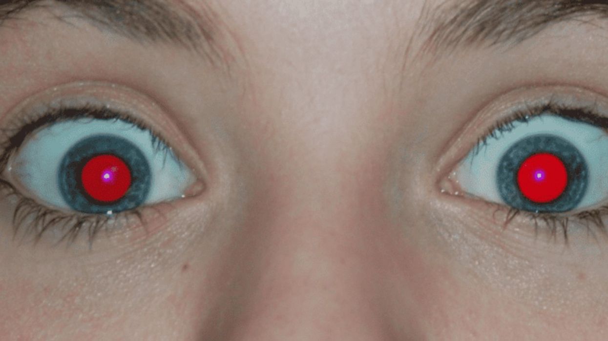 Boy pictured with red eyes