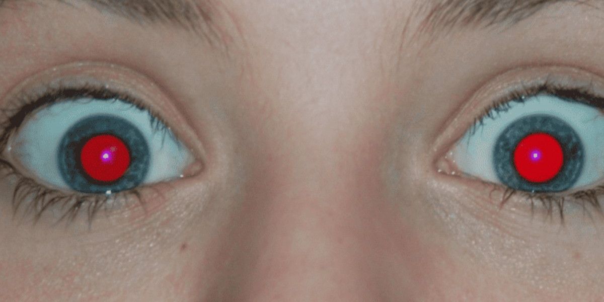 Red eye in photos can signal retina is healthy