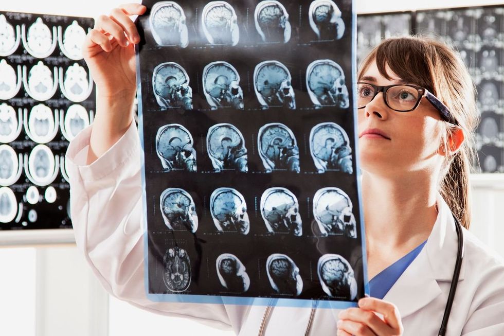 BRAIN IMAGING