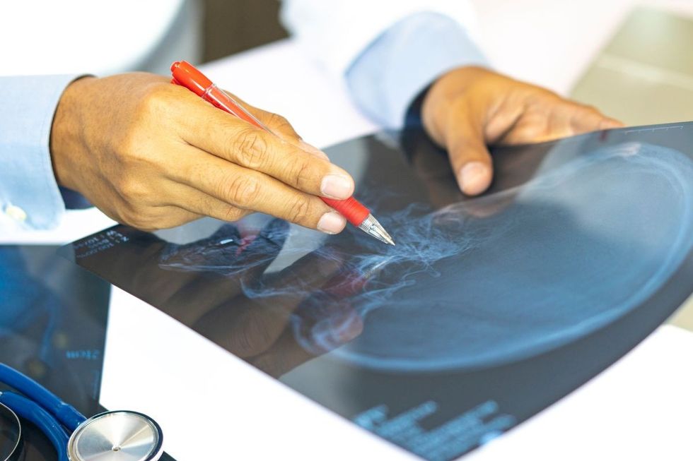 brain imagining in doctor's hand