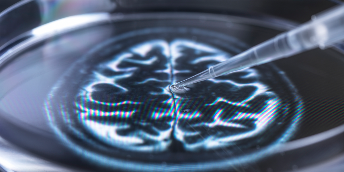 NextImg:Britons furious after new drug found to slow Alzheimer's for the first time is BLOCKED on NHS: 'Disgraceful!'