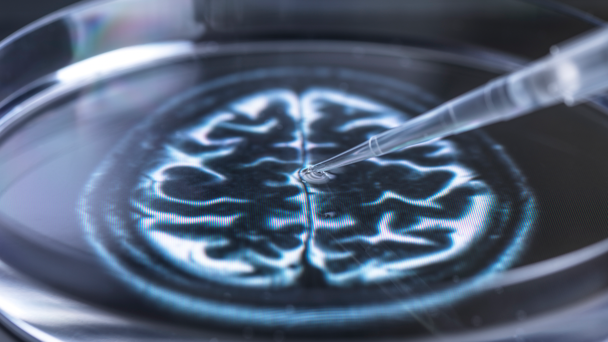 Brain research