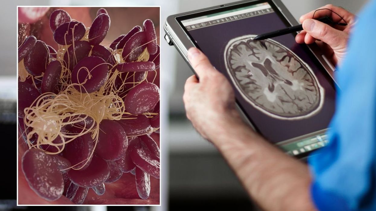 BRAIN SCAN AND BLOOD CELLS