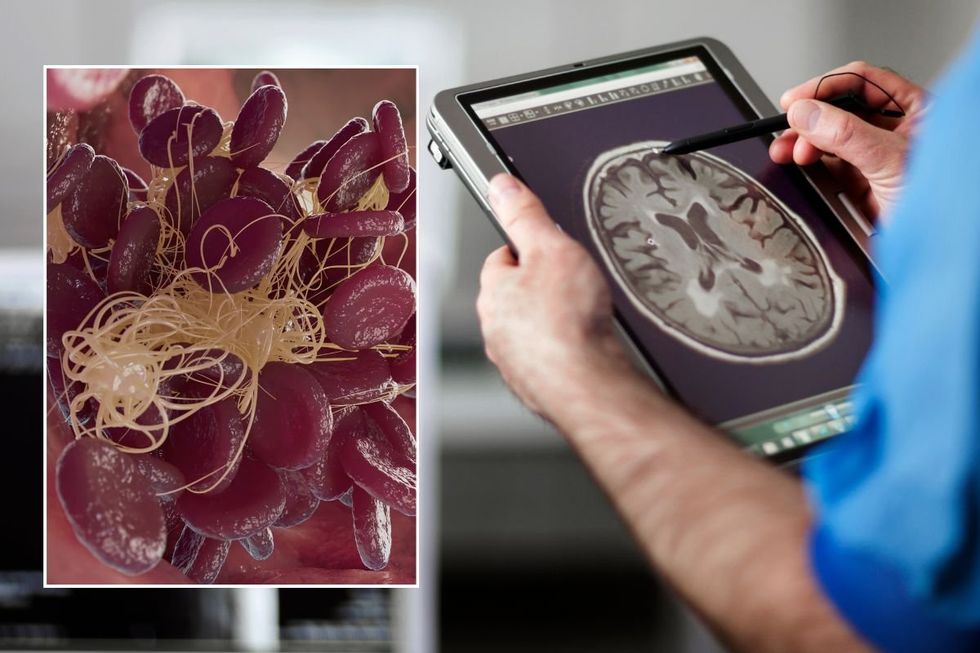 BRAIN SCAN AND BLOOD CELLS