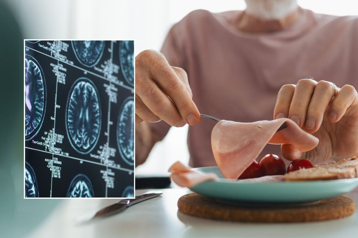 BRAIN SCAN AND EATING MAN