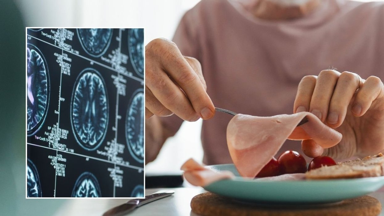 BRAIN SCAN AND EATING MAN