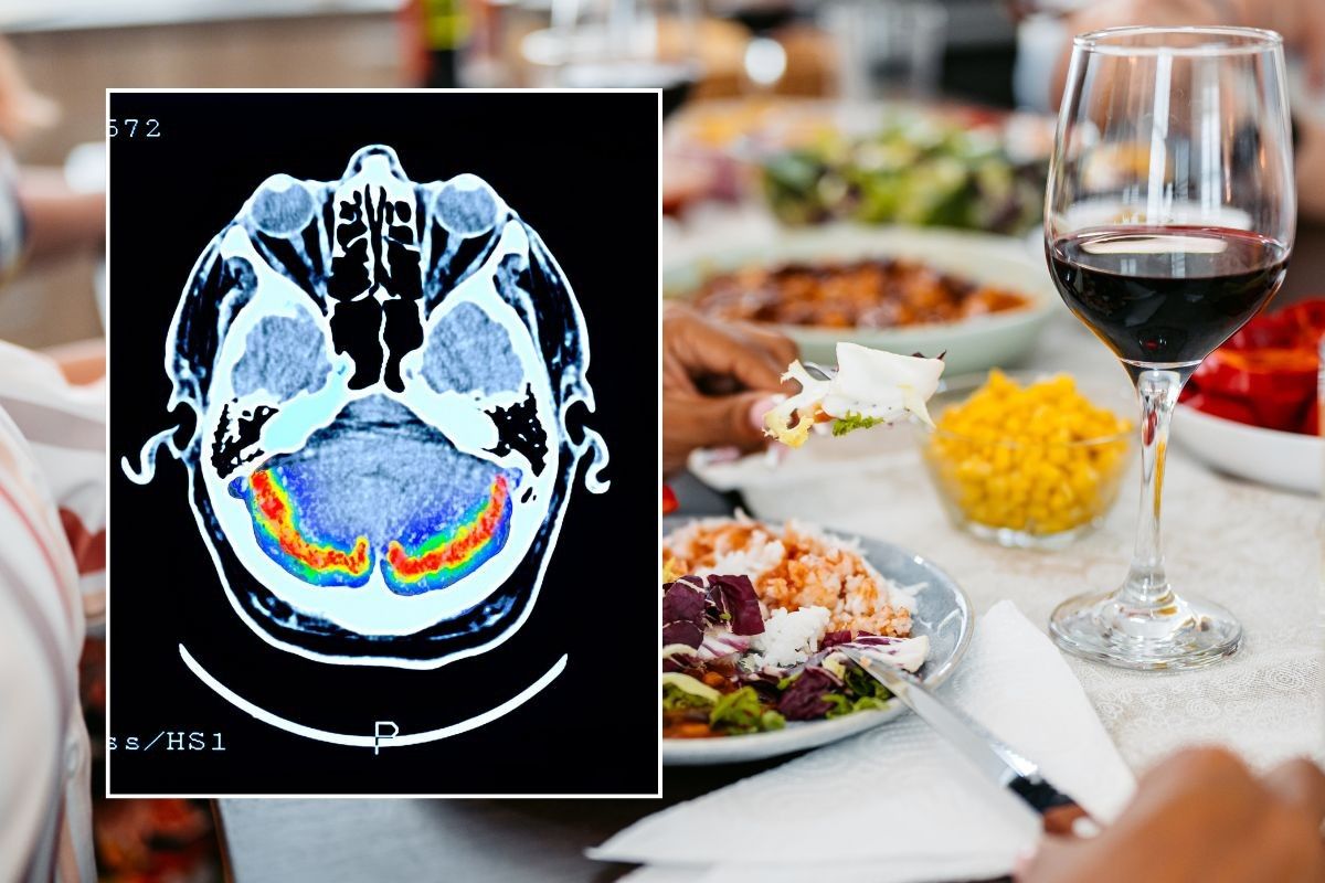 BRAIN SCAN AND GLASS OF WINE