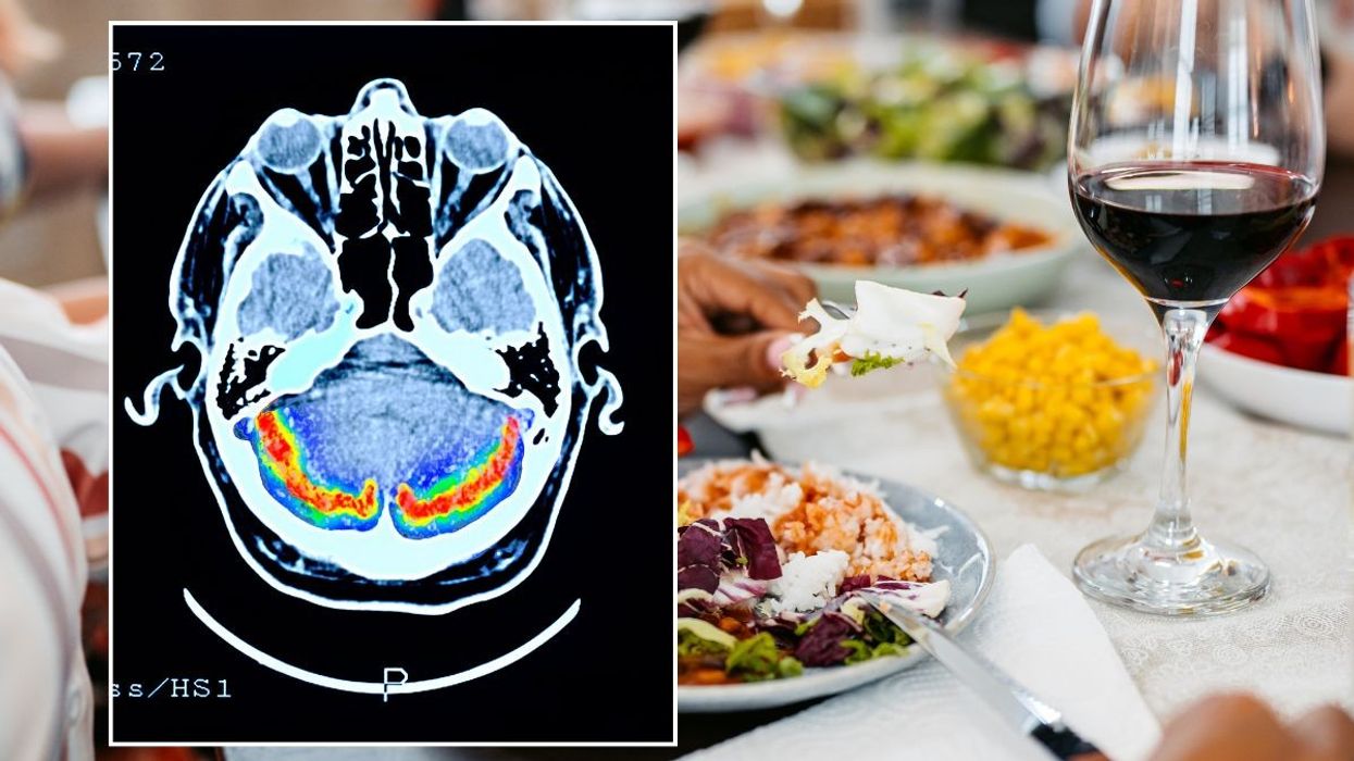 BRAIN SCAN AND GLASS OF WINE