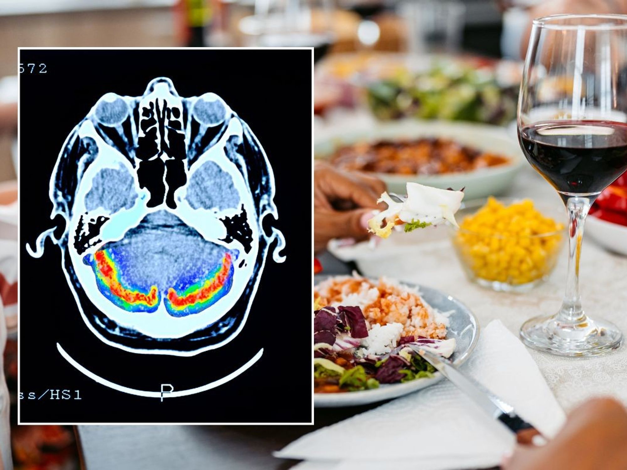 BRAIN SCAN AND GLASS OF WINE