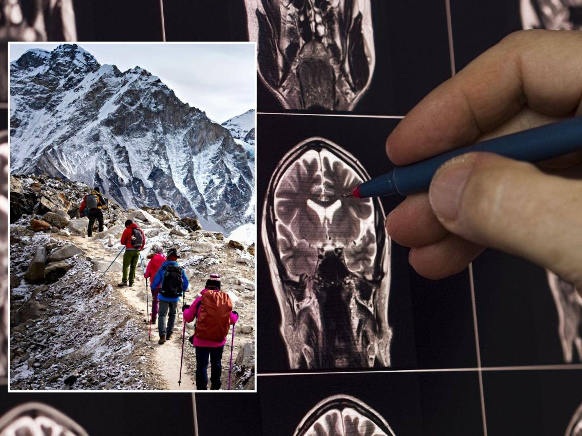 brain scan and mount everest