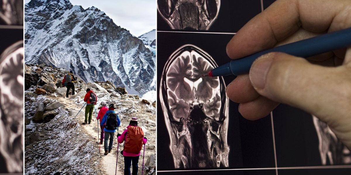 NextImg:Breathing Mount Everest air shows promise in halting Parkinson's disease symptoms, scientists say