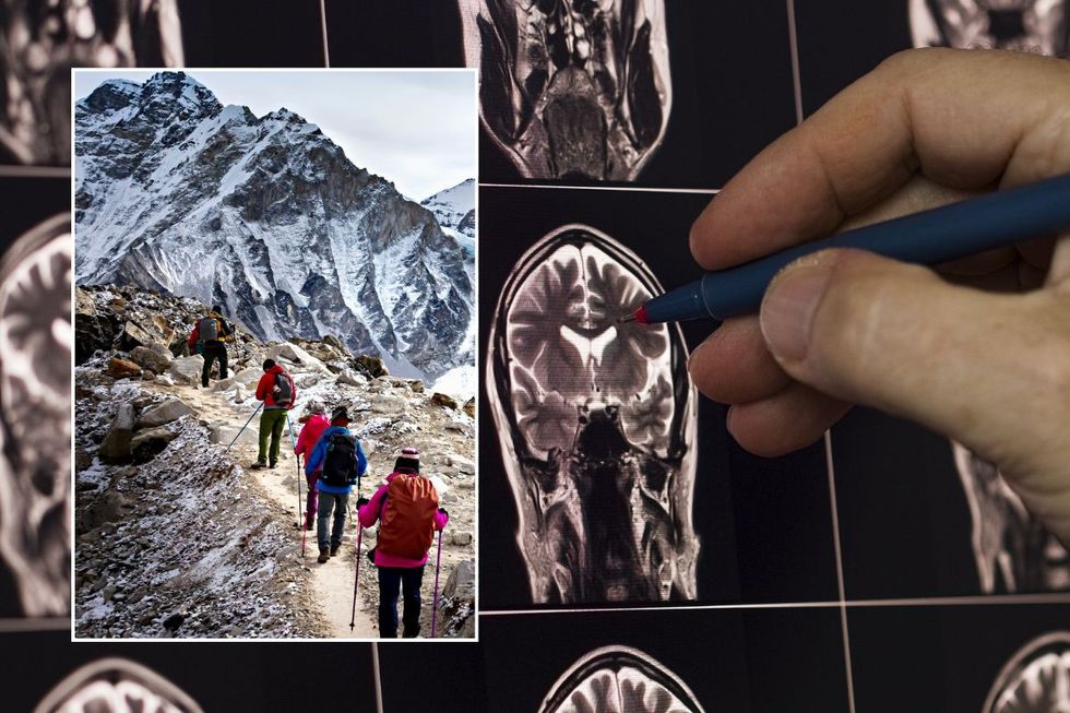 brain scan and mount everest