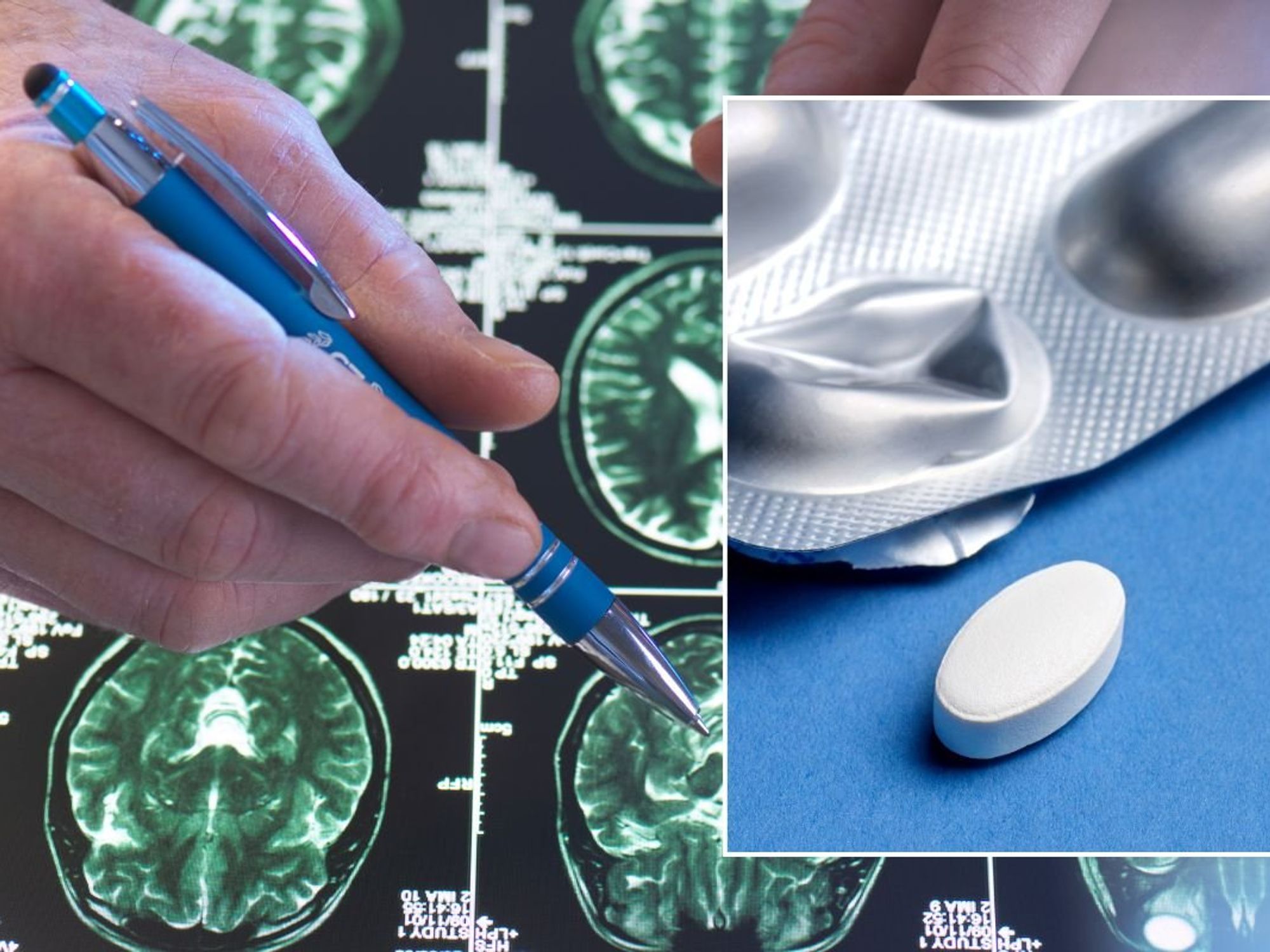 BRAIN SCAN AND WHITE PILL