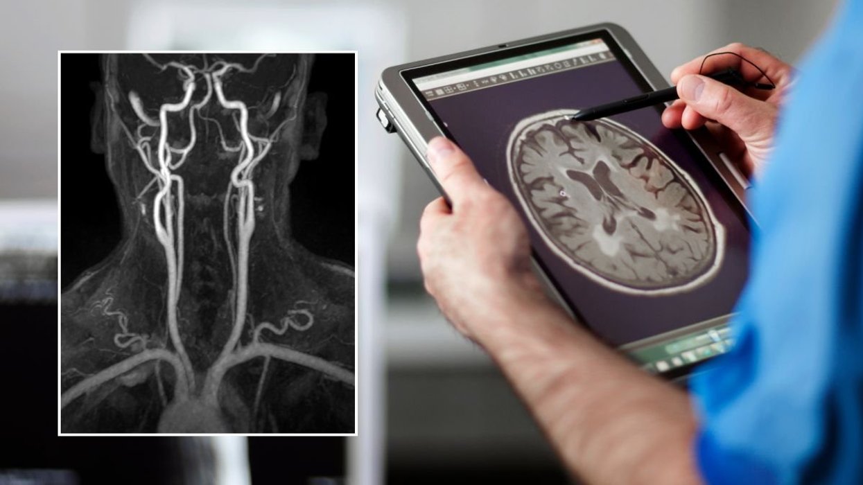 BRAIN SCAN AND X-RAY