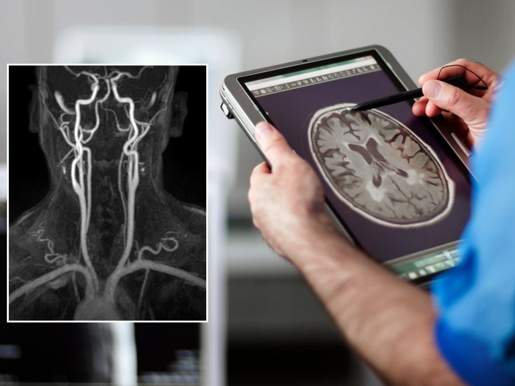 BRAIN SCAN AND X-RAY