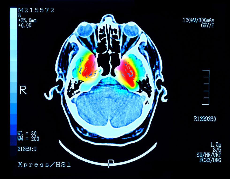 ‘I am a neuroscientist – workout is essentially the most tough technique to develop mind cells, however some sorts paintings higher’