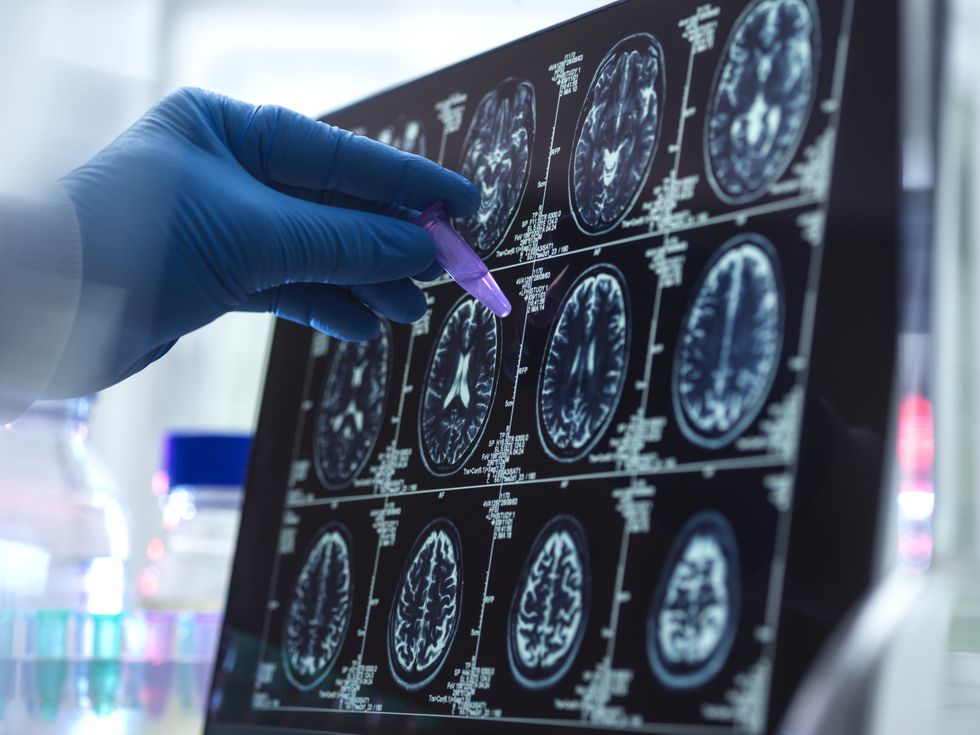 BRAIN SCAN