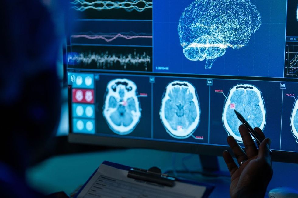 BRAIN SCAN