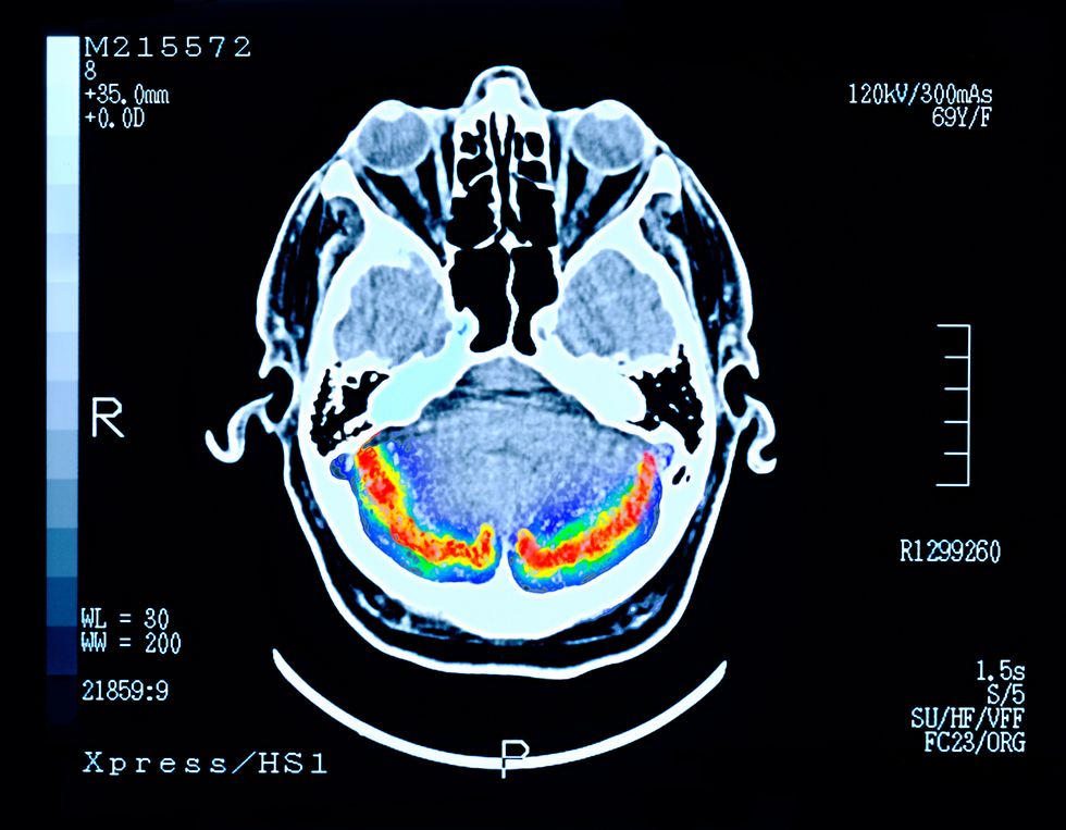 BRAIN SCAN